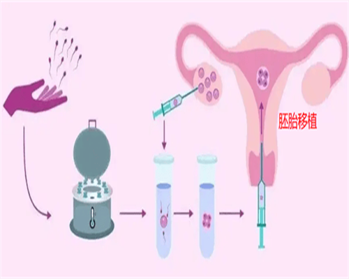 南京三代试管助孕费用解析：迟发性脊椎骨骼发育不全的遗传筛查与代怀选择