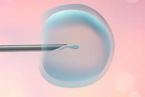 宫腔粘连患者试管婴儿费用解析及三代试管怀孕指南